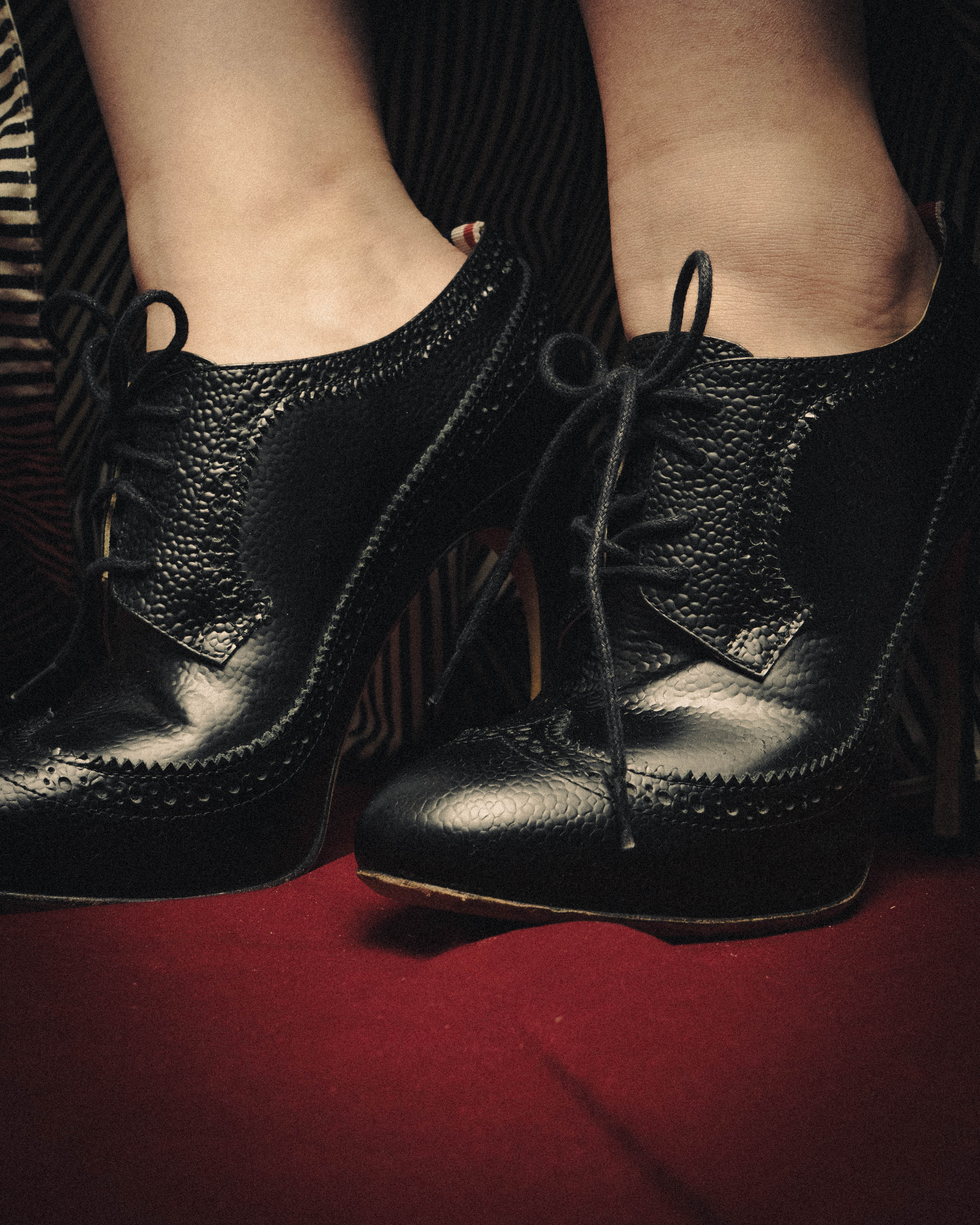-SPECIAL- “Thom Browne” 2010’s- pebbled leather wingtip lace-up heels